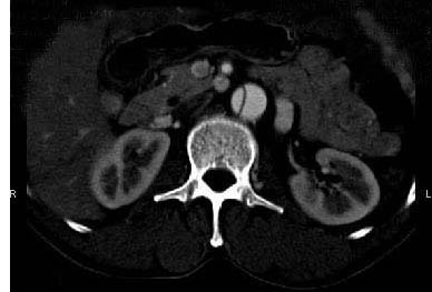 2012年卫生高级职称考试心血管内科试题及答