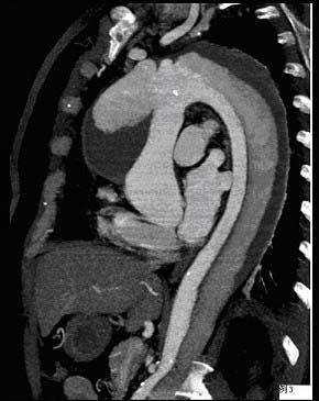 2012年卫生高级职称考试心血管内科试题及答