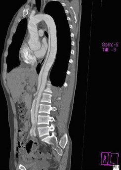 2012年卫生高级职称考试心血管内科试题及答
