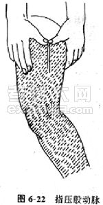 护士指导:现场外伤急救技第3页|百分百考试网